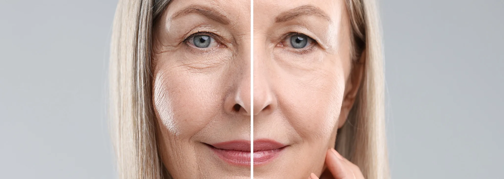 rejuvenecimiento facial sevilla